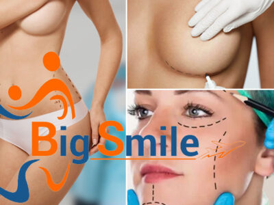 Chirurgia estetica Big Smile Chirurgia estetica (Savings Card - Movida Shop)